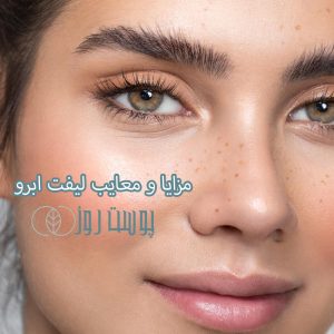 لیفت ابرو